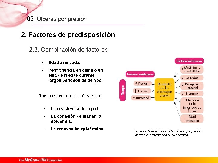 05 Úlceras por presión 2. Factores de predisposición 2. 3. Combinación de factores •