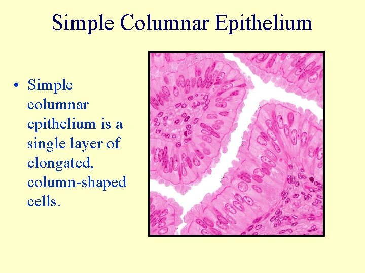 Simple Columnar Epithelium • Simple columnar epithelium is a single layer of elongated, column-shaped