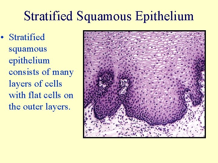 Stratified Squamous Epithelium • Stratified squamous epithelium consists of many layers of cells with