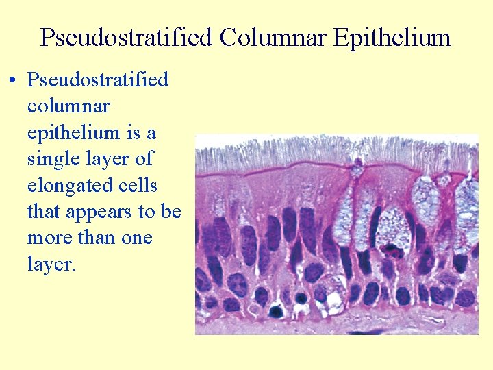 Pseudostratified Columnar Epithelium • Pseudostratified columnar epithelium is a single layer of elongated cells