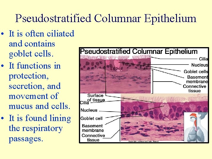 Pseudostratified Columnar Epithelium • It is often ciliated and contains goblet cells. • It