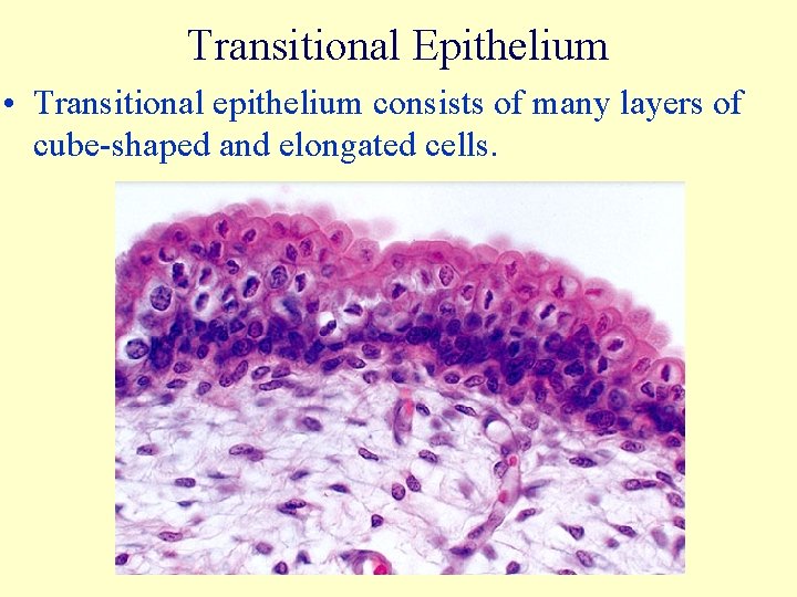 Transitional Epithelium • Transitional epithelium consists of many layers of cube-shaped and elongated cells.