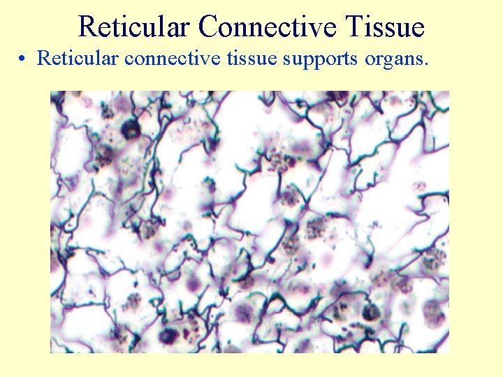 Reticular Connective Tissue • Reticular connective tissue supports organs. 