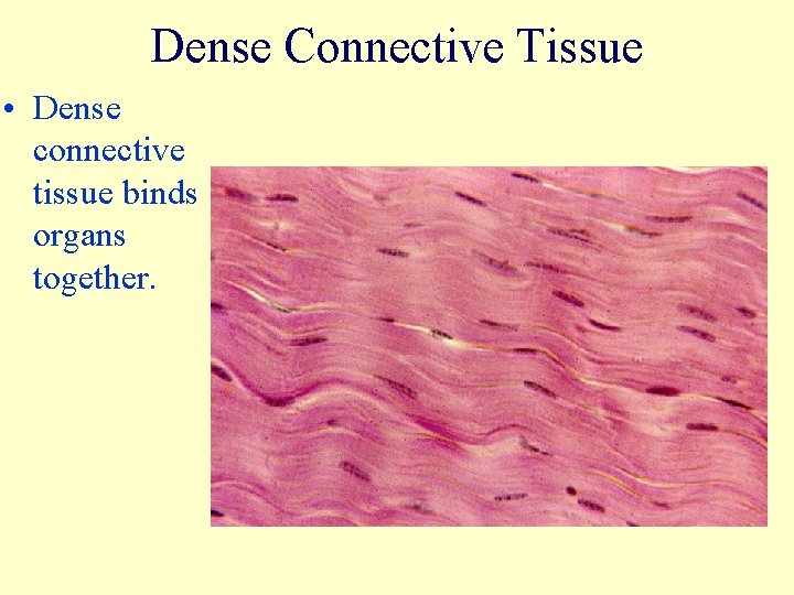 Dense Connective Tissue • Dense connective tissue binds organs together. 