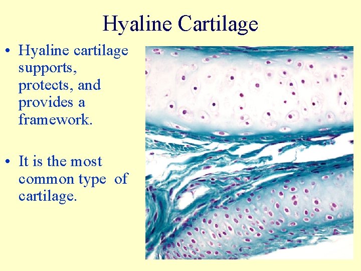 Hyaline Cartilage • Hyaline cartilage supports, protects, and provides a framework. • It is