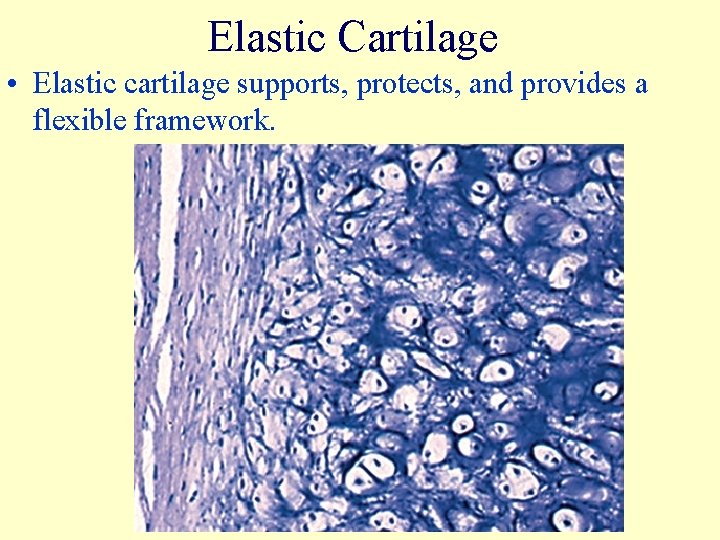 Elastic Cartilage • Elastic cartilage supports, protects, and provides a flexible framework. 