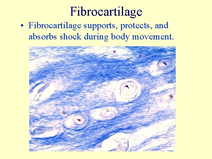 Fibrocartilage • Fibrocartilage supports, protects, and absorbs shock during body movement. 