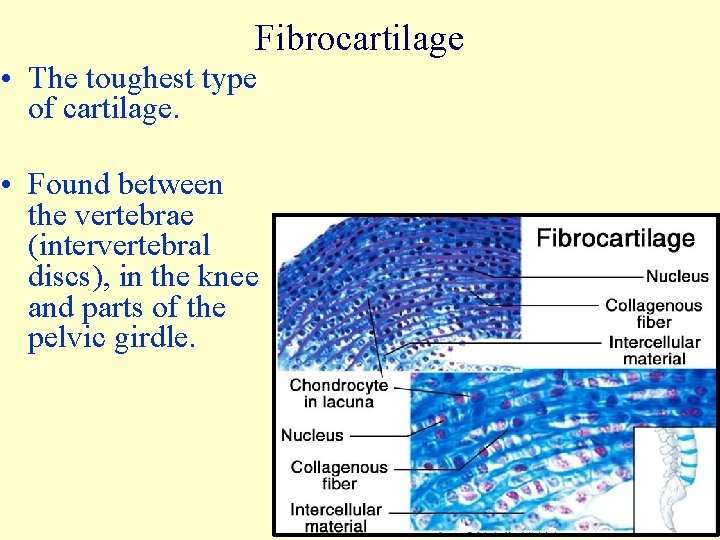 Fibrocartilage • The toughest type of cartilage. • Found between the vertebrae (intervertebral discs),