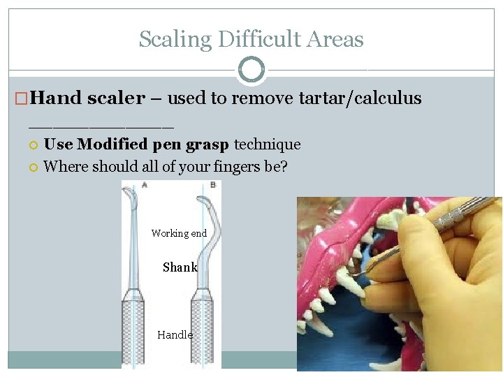 Scaling Difficult Areas �Hand scaler – used to remove tartar/calculus ______ Use Modified pen