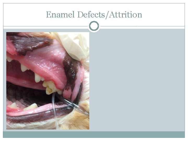 Enamel Defects/Attrition 
