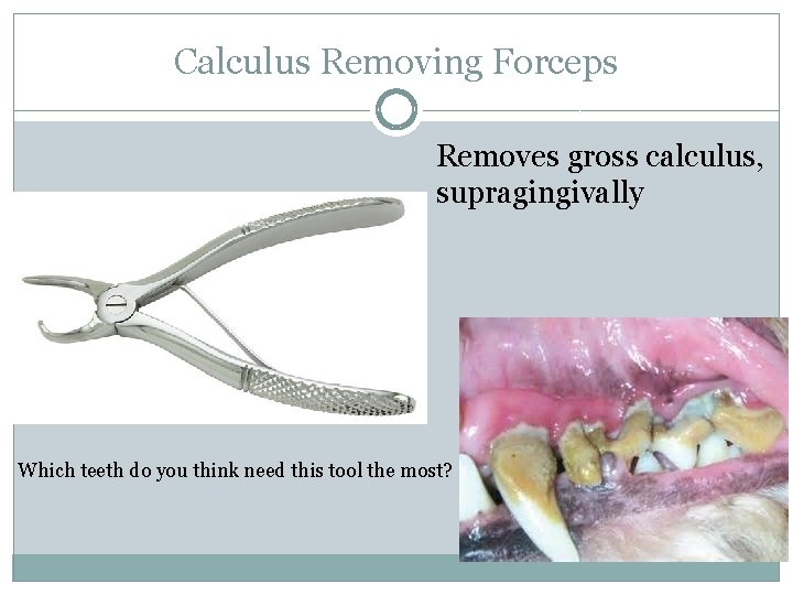 Calculus Removing Forceps Removes gross calculus, supragingivally Which teeth do you think need this
