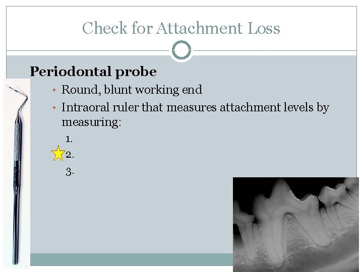 Check for Attachment Loss Periodontal probe • Round, blunt working end • Intraoral ruler