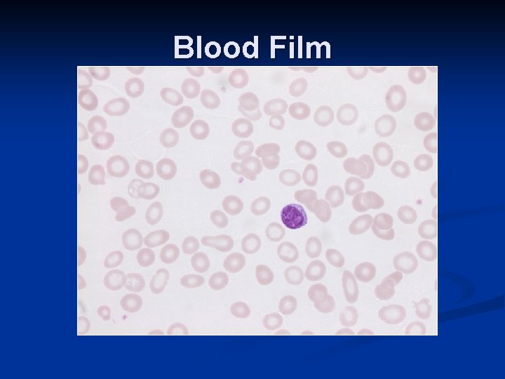 Blood Film 