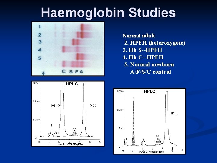 Haemoglobin Studies Normal adult 2. HPFH (heterozygote) 3. Hb S--HPFH 4. Hb C--HPFH 5.