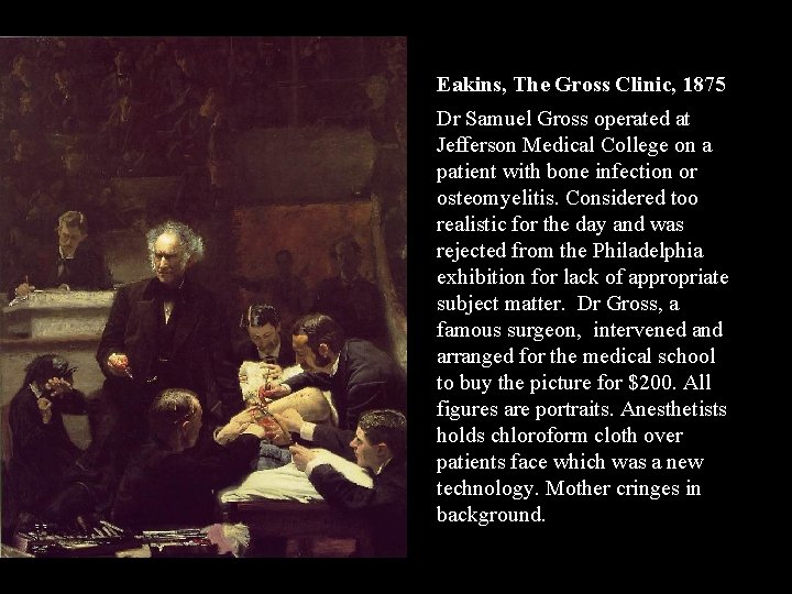 Eakins, The Gross Clinic, 1875 Dr Samuel Gross operated at Jefferson Medical College on