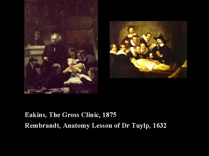 Eakins, The Gross Clinic, 1875 Rembrandt, Anatomy Lesson of Dr Tuylp, 1632 