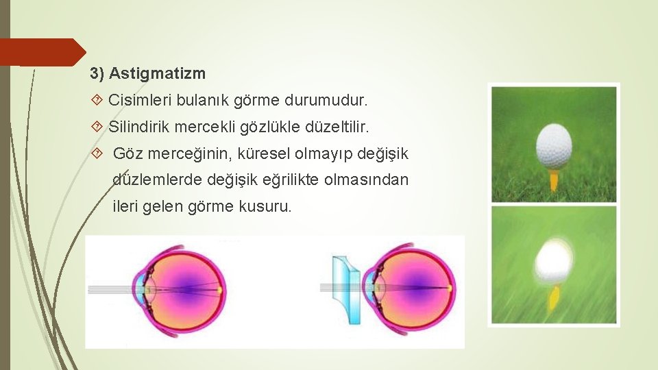 3) Astigmatizm Cisimleri bulanık görme durumudur. Silindirik mercekli gözlükle düzeltilir. Göz merceğinin, küresel olmayıp