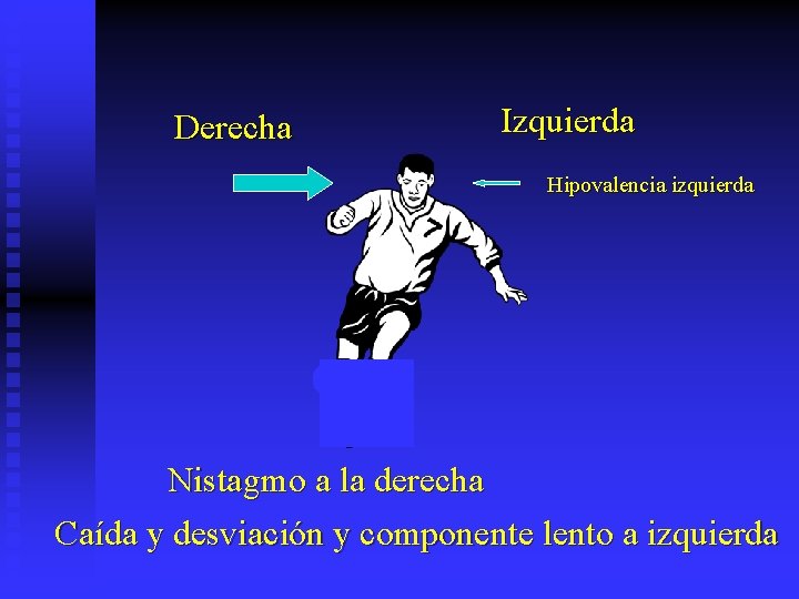 Derecha Izquierda Hipovalencia izquierda Nistagmo a la derecha Caída y desviación y componente lento