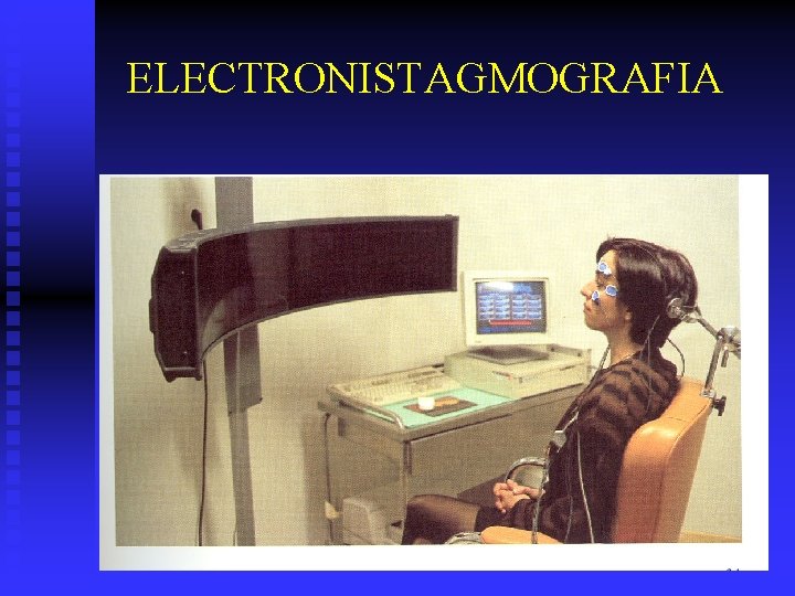 ELECTRONISTAGMOGRAFIA 