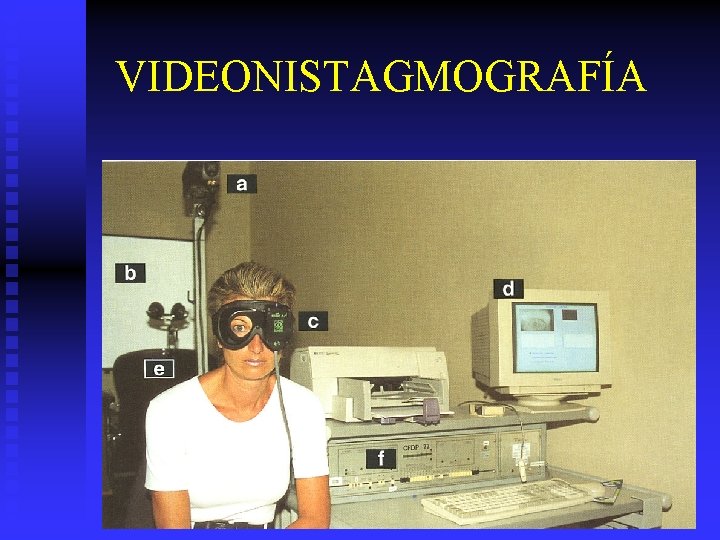 VIDEONISTAGMOGRAFÍA 