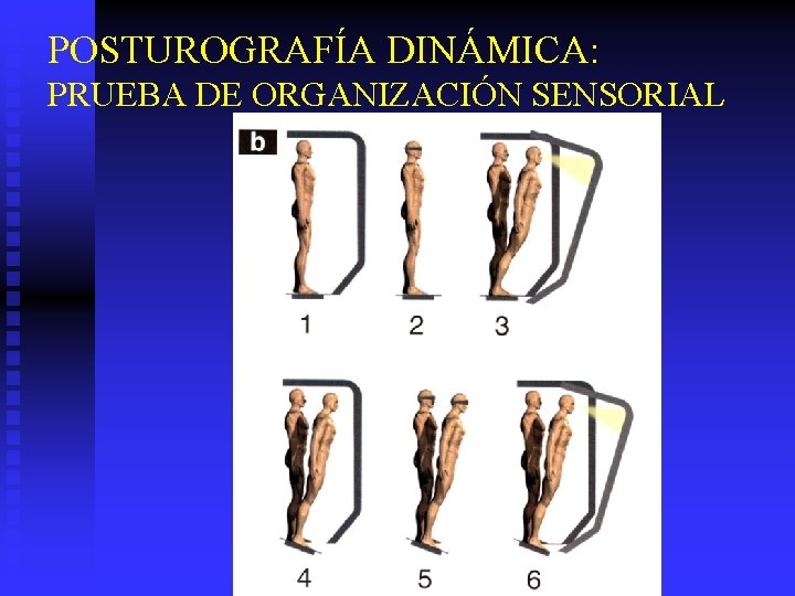 POSTUROGRAFÍA DINÁMICA: PRUEBA DE ORGANIZACIÓN SENSORIAL 