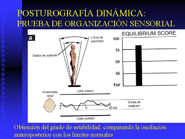 POSTUROGRAFÍA DINÁMICA: PRUEBA DE ORGANIZACIÓN SENSORIAL Obtención del grado de estabilidad: comparando la oscilación