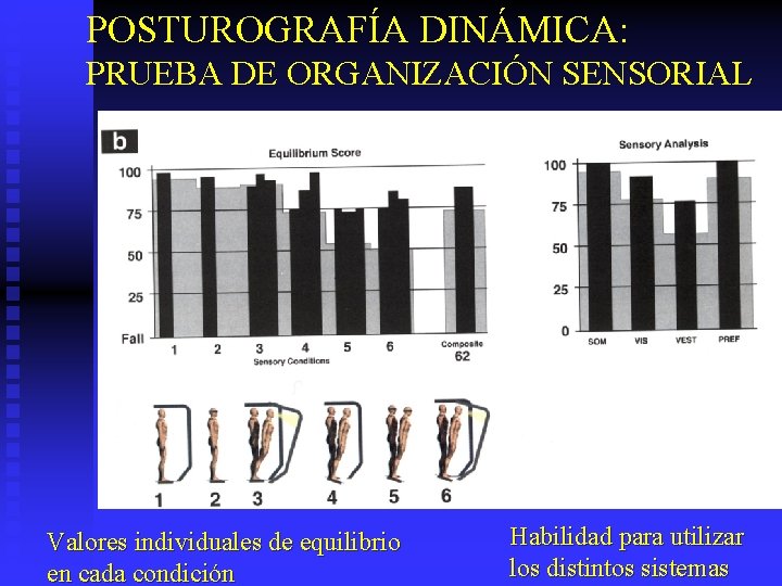 POSTUROGRAFÍA DINÁMICA: PRUEBA DE ORGANIZACIÓN SENSORIAL Valores individuales de equilibrio en cada condición Habilidad