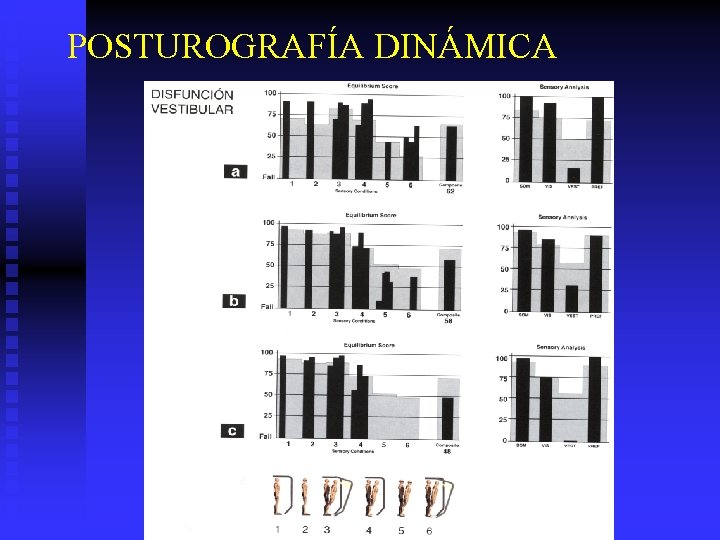 POSTUROGRAFÍA DINÁMICA 