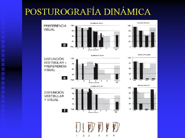 POSTUROGRAFÍA DINÁMICA 