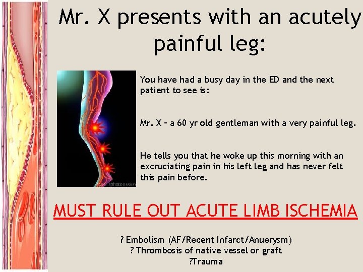 Mr. X presents with an acutely painful leg: You have had a busy day