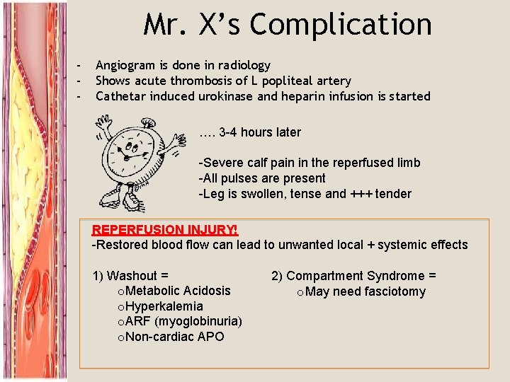 Mr. X’s Complication - Angiogram is done in radiology Shows acute thrombosis of L