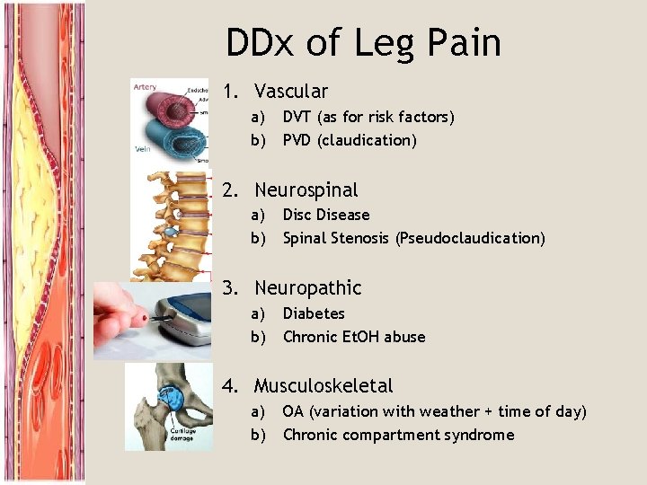 DDx of Leg Pain 1. Vascular a) b) DVT (as for risk factors) PVD