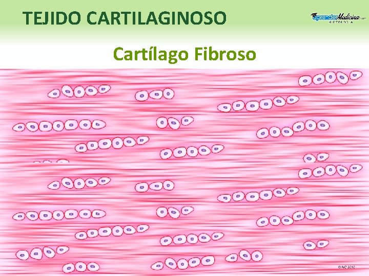 TEJIDO CARTILAGINOSO Cartílago Fibroso 