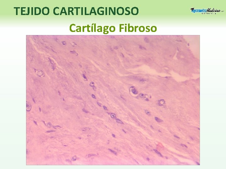 TEJIDO CARTILAGINOSO Cartílago Fibroso 