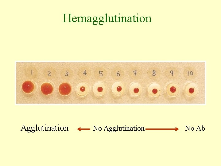 Hemagglutination Agglutination No Ab 