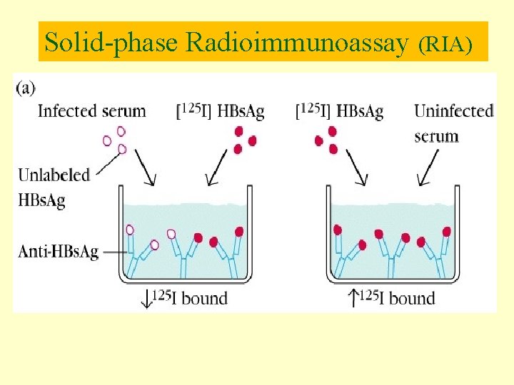 Solid-phase Radioimmunoassay (RIA) 