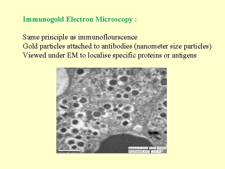 Immunogold Electron Microscopy : Same principle as immunoflourscence Gold particles attached to antibodies (nanometer