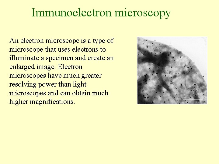 Immunoelectron microscopy An electron microscope is a type of microscope that uses electrons to