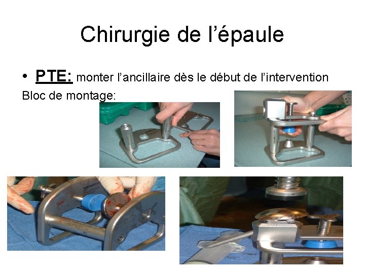 Chirurgie de l’épaule • PTE: monter l’ancillaire dès le début de l’intervention Bloc de