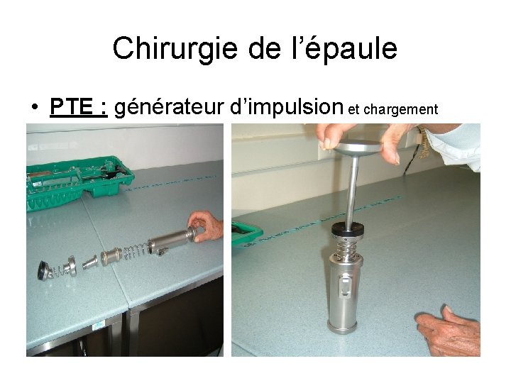 Chirurgie de l’épaule • PTE : générateur d’impulsion et chargement 