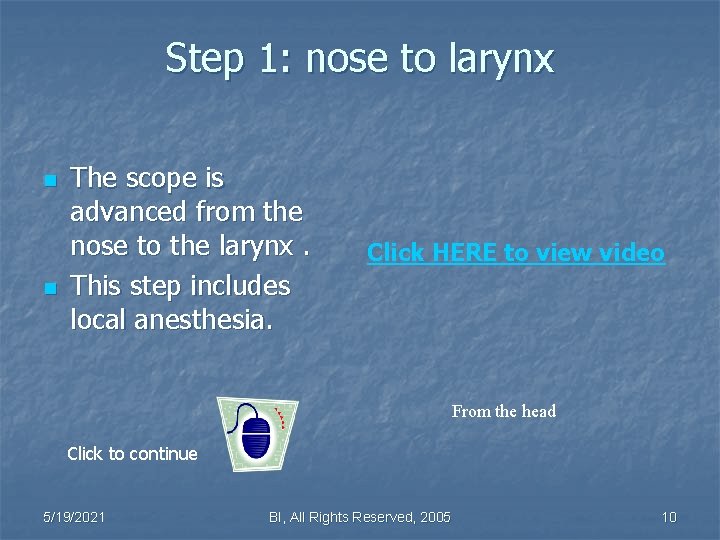 Step 1: nose to larynx n n The scope is advanced from the nose
