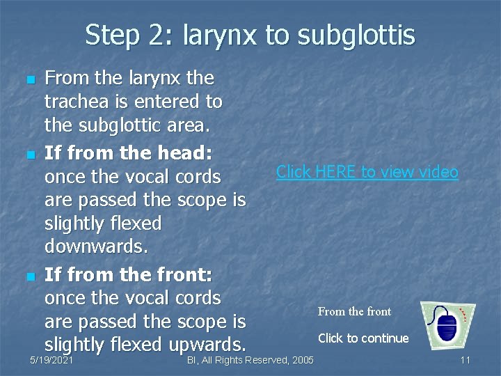 Step 2: larynx to subglottis n n n From the larynx the trachea is