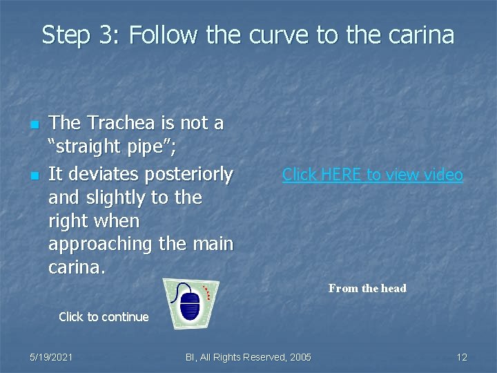 Step 3: Follow the curve to the carina n n The Trachea is not