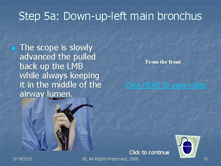 Step 5 a: Down-up-left main bronchus n The scope is slowly advanced the pulled
