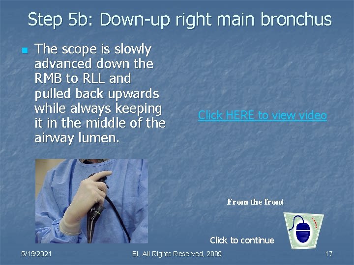 Step 5 b: Down-up right main bronchus n The scope is slowly advanced down