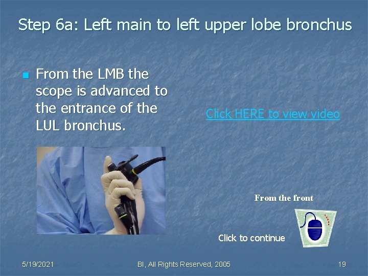 Step 6 a: Left main to left upper lobe bronchus n From the LMB
