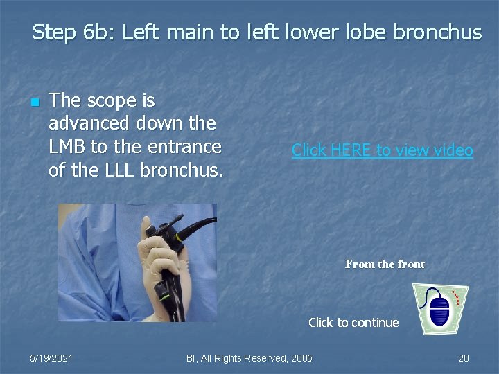 Step 6 b: Left main to left lower lobe bronchus n The scope is