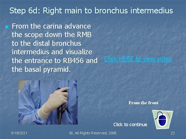 Step 6 d: Right main to bronchus intermedius n From the carina advance the