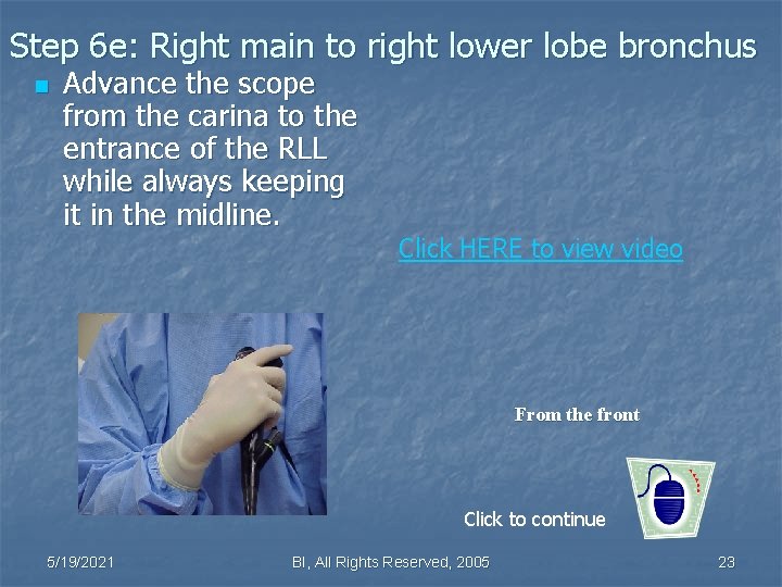 Step 6 e: Right main to right lower lobe bronchus n Advance the scope Step 6 e: Right main to right lower lobe bronchus n Advance the scope