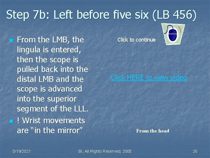 Step 7 b: Left before five six (LB 456) n n From the LMB,